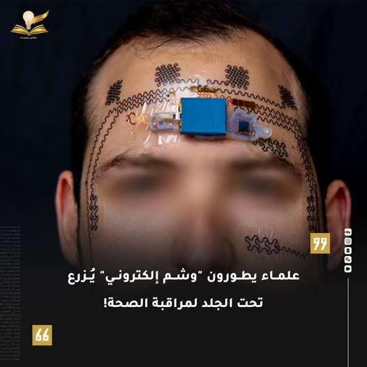 جهازاً بحجم حبة الأرز يُزرع تحت الجلد لمراقبة المؤشرات الحيوية